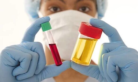 vyšetření krve a moči před operací augmentace prsou