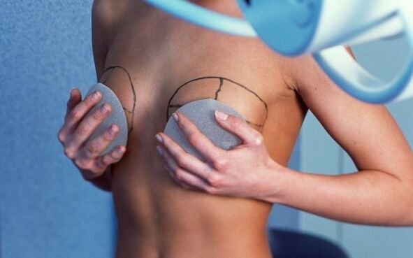 zvětšení prsou pomocí implantátů